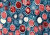 M-Pox: how can it be controlled spreading?