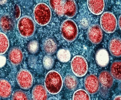 M-Pox: how can it be controlled spreading?